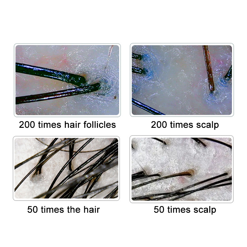 200/50X Skóra Włosy Skóra głow – Hair Porosity Test recenzja i cena