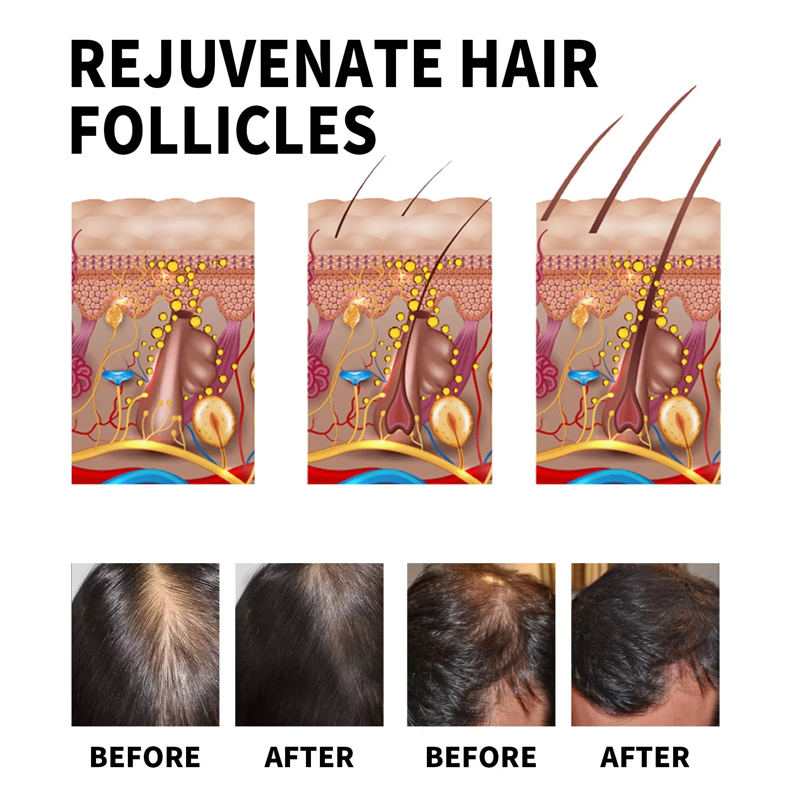 Produkty na porost włosów z im – Hair Care For Dry And Frizzy Hair recenzja i cena